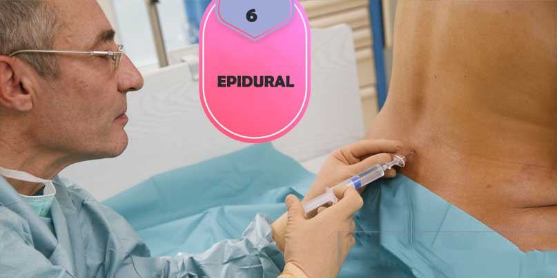 Epidural-to-deal-with-birth-pain