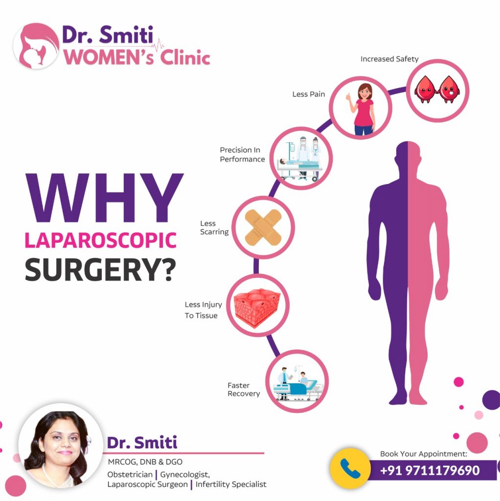 post-What-is-Laparoscopy-Surgery-and-why-it-is-important