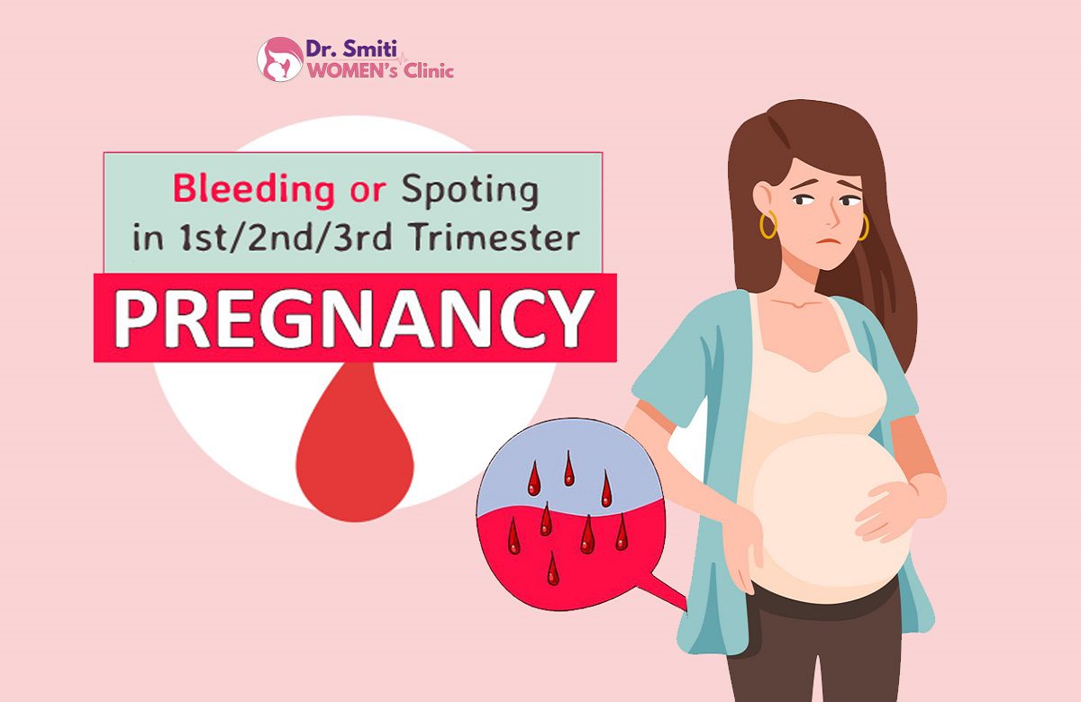 post-bleeding-in-pregnancy-symptoms-treatments