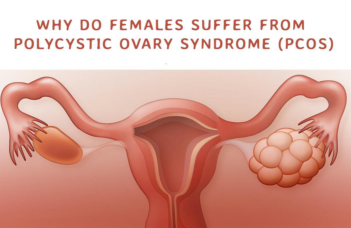 post-why-do-females-suffer-from-polycystic-ovary-syndrome-pcos