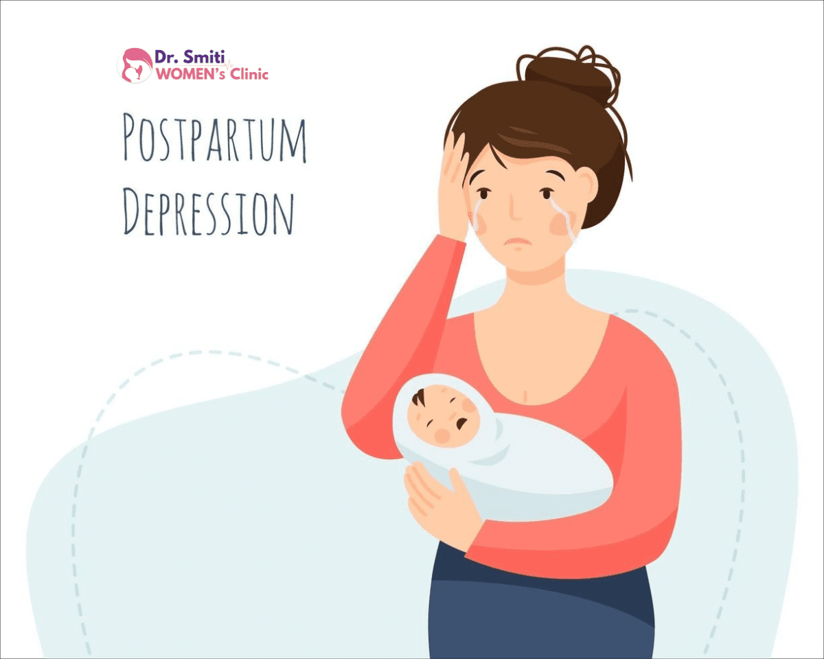 Postpartum Depression: A Guide to Symptoms, Treatment & Diet!