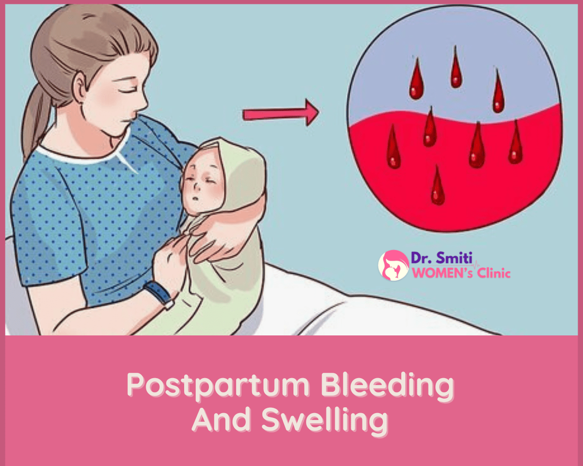 Postpartum bleeding and swelling