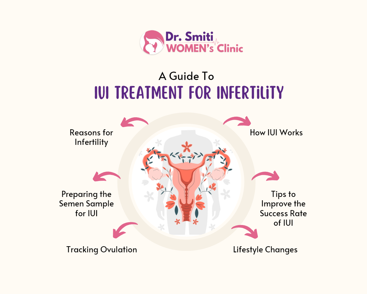 A Guide To IUI Treatment for Infertility