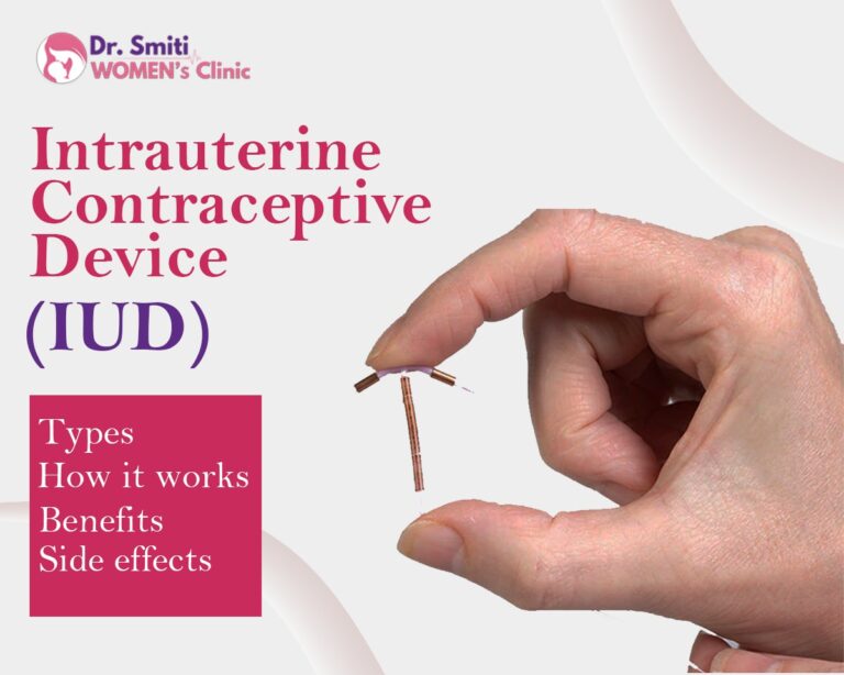 Iud Testing Intrauterine Contraceptive Device (IUD): A Comprehensive Guide by Dr ...