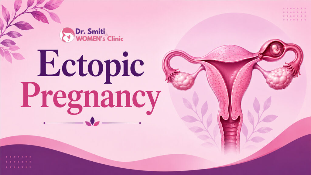 Ectopic-Pregnancy