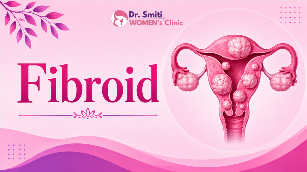 Fibroid