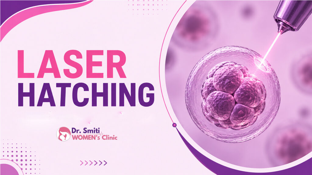 Laser-Hatching